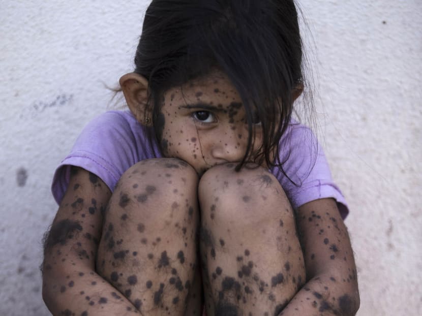 Argentines link health problems to agrochemicals