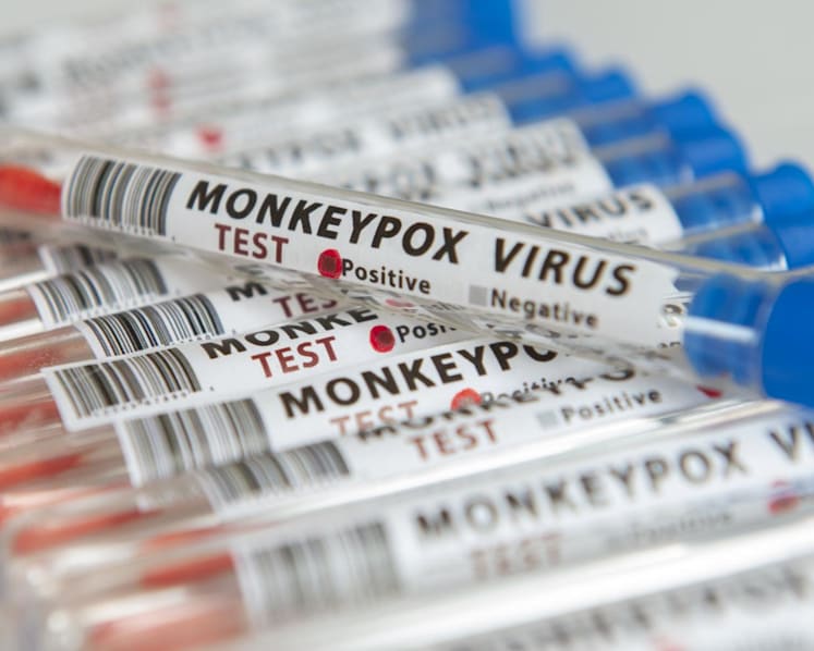 MOH doesn't recommend mass vaccination against monkeypox as 'benefits do not outweigh risk': Ong Ye Kung