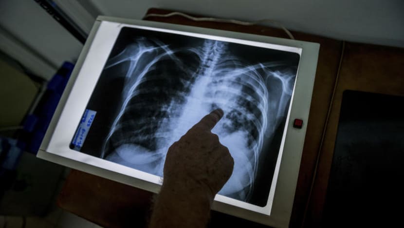 No need for closure of centre in Bukit Batok after TB case reported: PCF Sparkletots