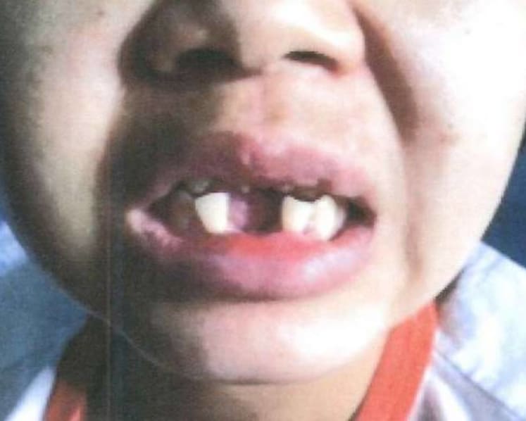 Jail for woman who hammered out maid’s teeth in 'worst' recent case of abuse
