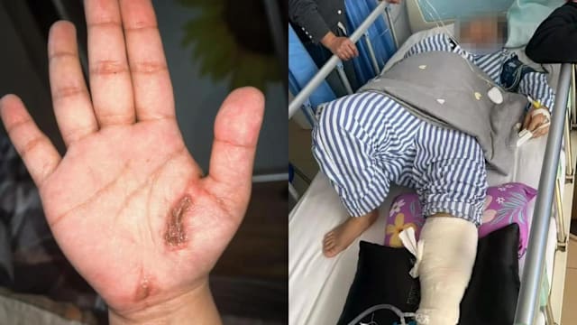 贵州女子边充电边玩手机 遭电击送院抢救