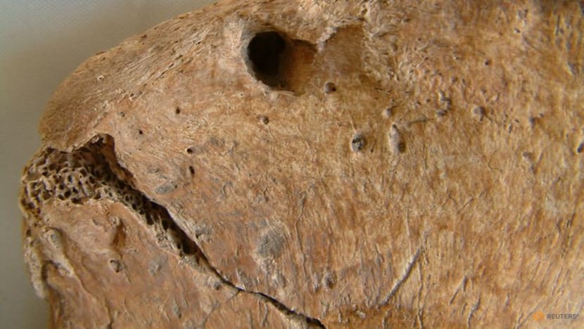Bite marks reveal gladiator's fatal encounter with a lion in ancient Britain