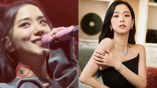 Jisoo颈部“肿起一块”　引粉丝担心健康状况