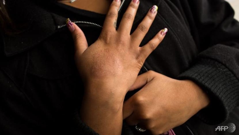 Commentary: Low self-esteem, depression and frequent flare-ups plague growing numbers of eczema sufferers Commentary: Low self-esteem, depression and frequent flare-ups plague growing numbers of eczema sufferers