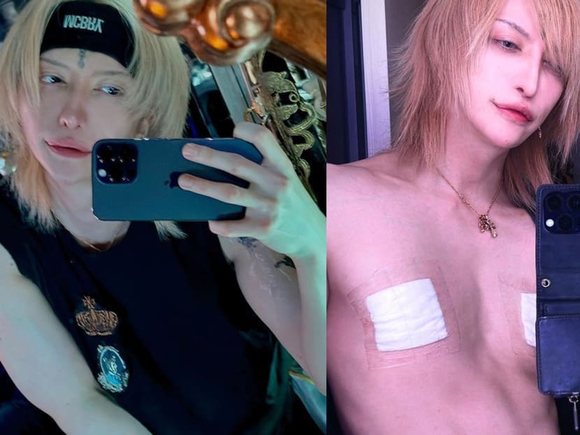 Japanese guitarist has surgery to remove his nipples, says 'men don’t need them'