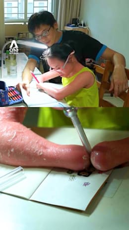Her skin keeps growing — caring for her takes a village