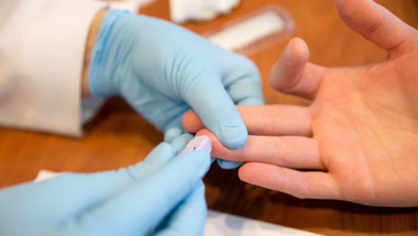 Commentary: HIV treatments have evolved, the law needs to catch up Commentary: HIV treatments have evolved, the law needs to catch up