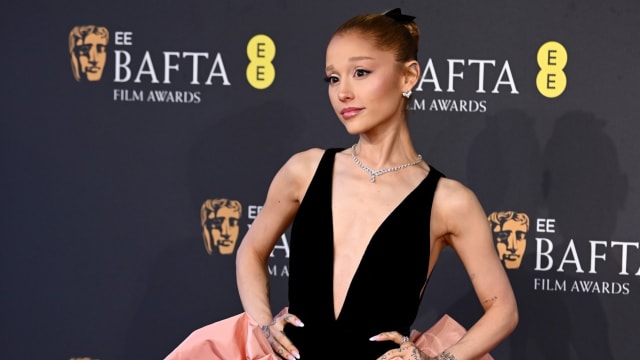 Ariana Grande暴瘦成纸片人！发线后移、容貌憔悴令健康引关注