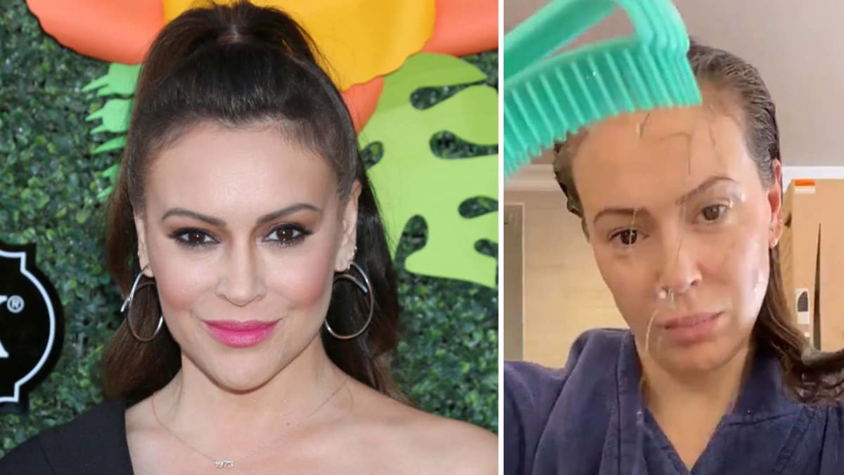 Alyssa Milano Is Losing Her Hair To COVID-19 - TODAY