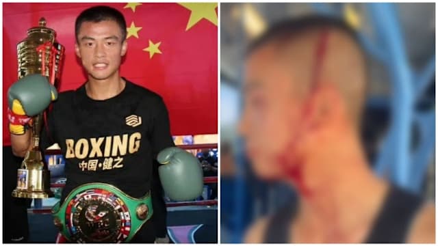 中国拳击手在澳洲遇种族袭击 头部遭螺丝刀扎伤