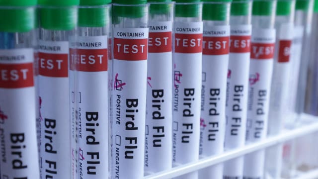 美国内华达州出现首起人类感染H5N1病例