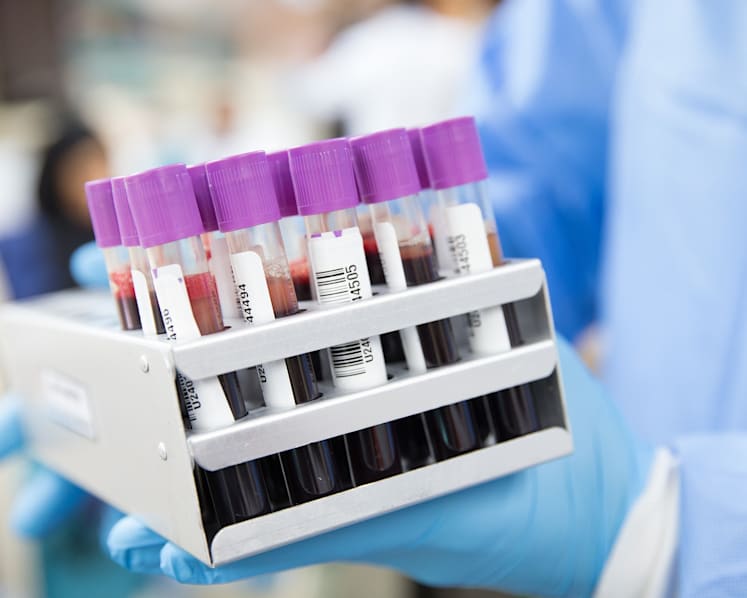 Singapore study finds link between Covid-19 and risk of blood clot formation even after recovery