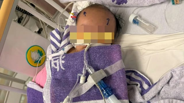 四个月大男婴疑遭虐打致脑出血 港警逮捕两帮佣