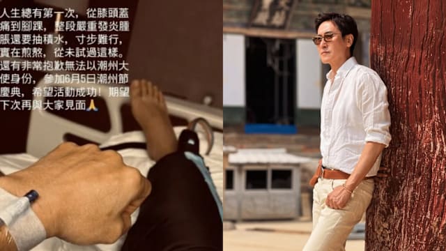 因急性关节炎引发水肿，马德钟住院一周接受治疗
