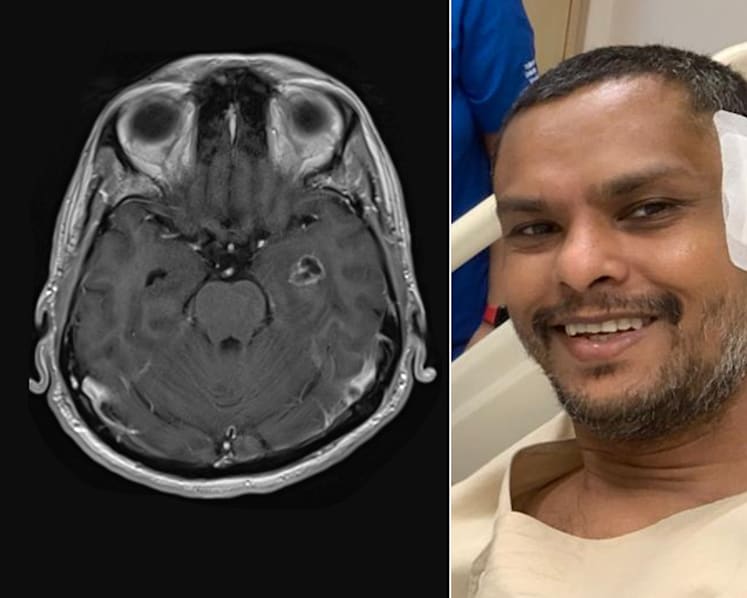 Man remarries wife after removal of brain tumour that was likely cause of behaviour change, family break-up