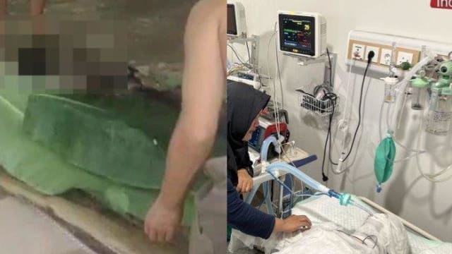 手机充电时印尼男子睡着 手机爆炸致90%烧伤