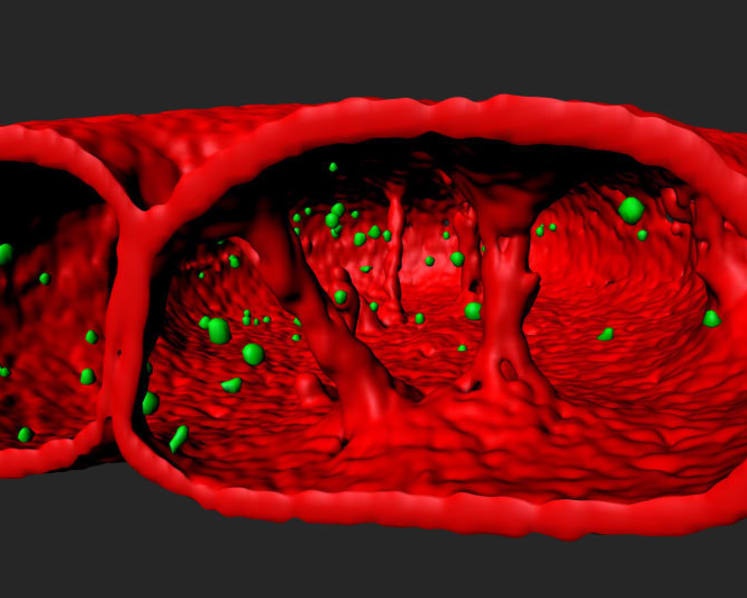 Research breakthrough in rare rapid ageing disease pave the way for new treatments