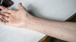 Related article image