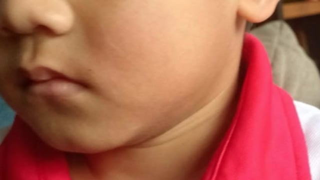 四岁童兀兰一带疑遭掌掴 家属寻目击者