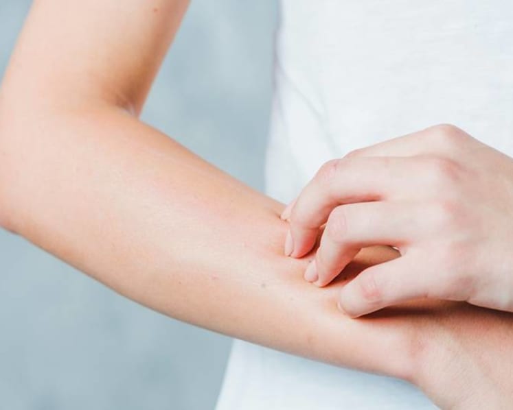 Unexplained rashes: Why do they occur and when should you see a doctor?