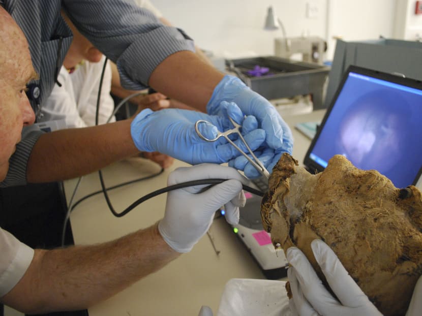 A photo provided by the Museum of Fine Arts, Boston, of a team of doctors from Massachusetts General Hospital extracting a tooth from the mummy head in 2009, hoping to extract DNA.