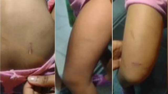 马国妇人来狮城工作 孩子托友人顾却被虐满身伤