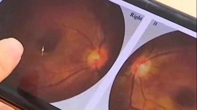 中国六月婴洗澡直视浴霸灯光  致视网膜灼伤终身弱视