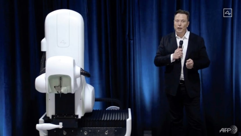 Commentary: Would you let Elon Musk implant a device in your brain? Commentary: Would you let Elon Musk implant a device in your brain?