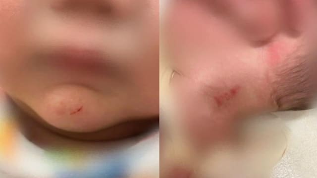 台湾两保姆涉虐婴 视力及听力皆受损