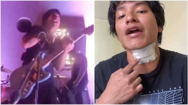 秘鲁酒吧出现惊险一幕 歌手疑因麦克风漏电触电倒地