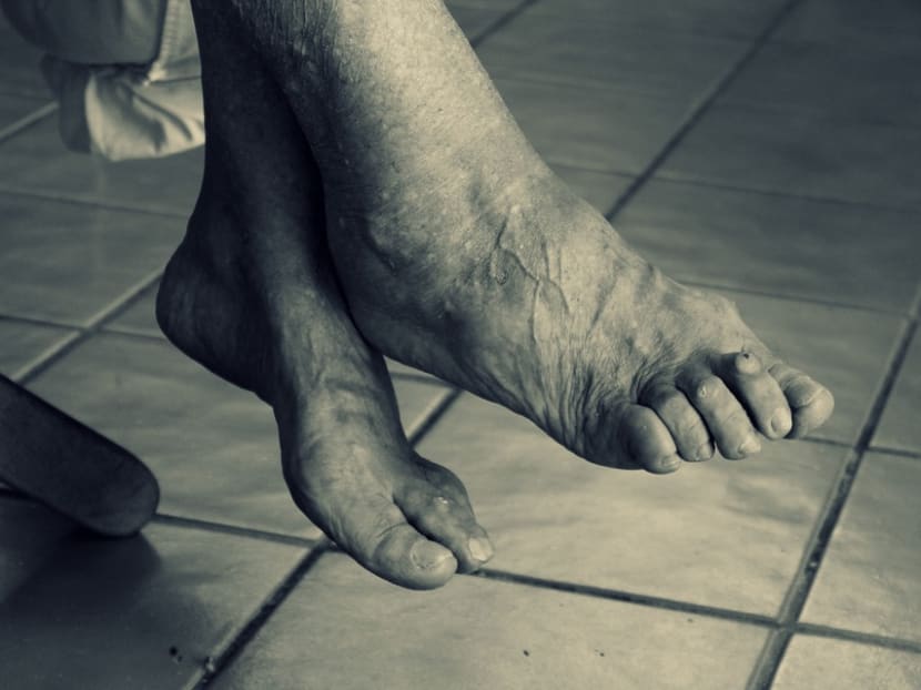 Court orders man to leave home, stop 'tormenting' 90-year-old mother with dementia; cites impact of caregiver stress