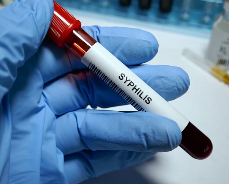 Syphilis is not dead: Dating apps, HIV pill, risky sex help push disease to forefront again