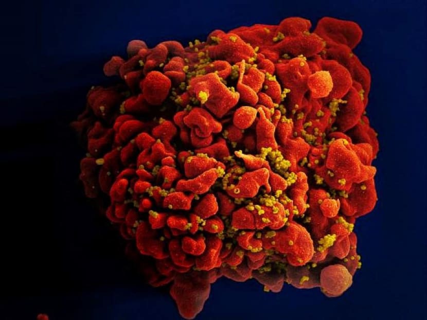 A human white blood cell infected with human immunodeficiency virus.