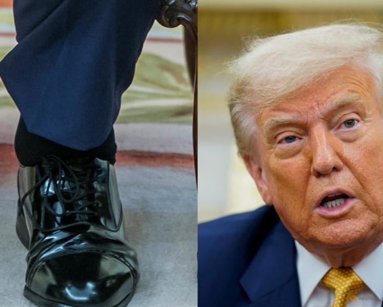 What is chronic venous insufficiency, the condition Trump was diagnosed with?