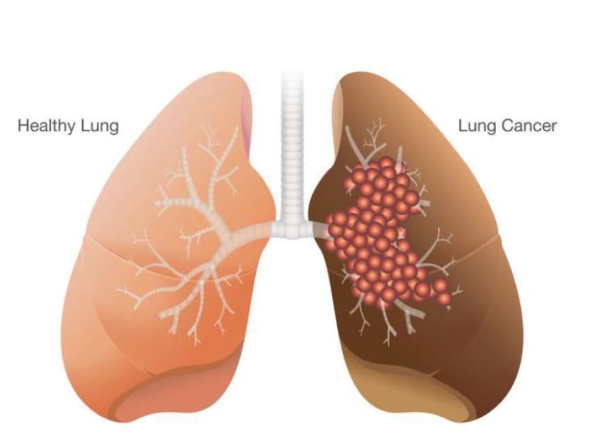 Graphic: A*STAR’s Genome Institute of Singapore)
