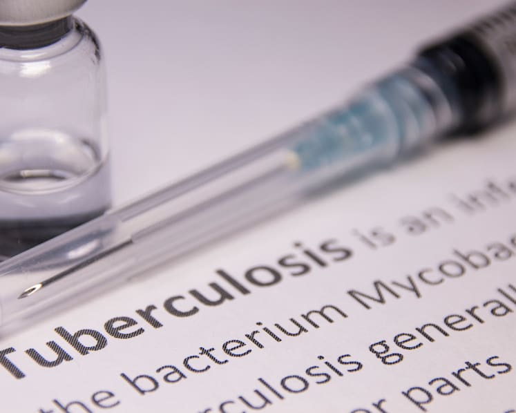 Commentary: Coercive measures to improve tuberculosis control may raise stigma — being more people-centred will help