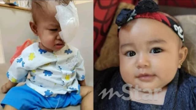 马国眼癌女童因化疗感灼热 每晚只想在冰箱前降温