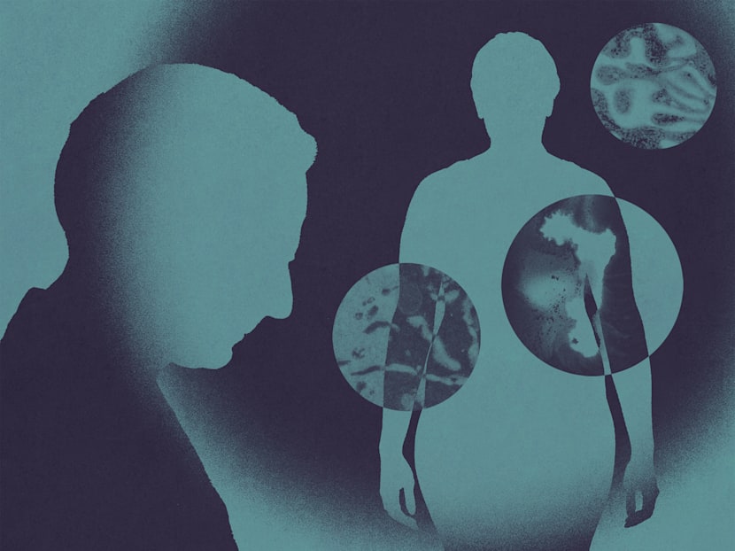 Why are more young people getting cancer today? Clues point back to the 1950s