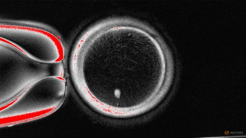 Scientists create human eggs using skin cells