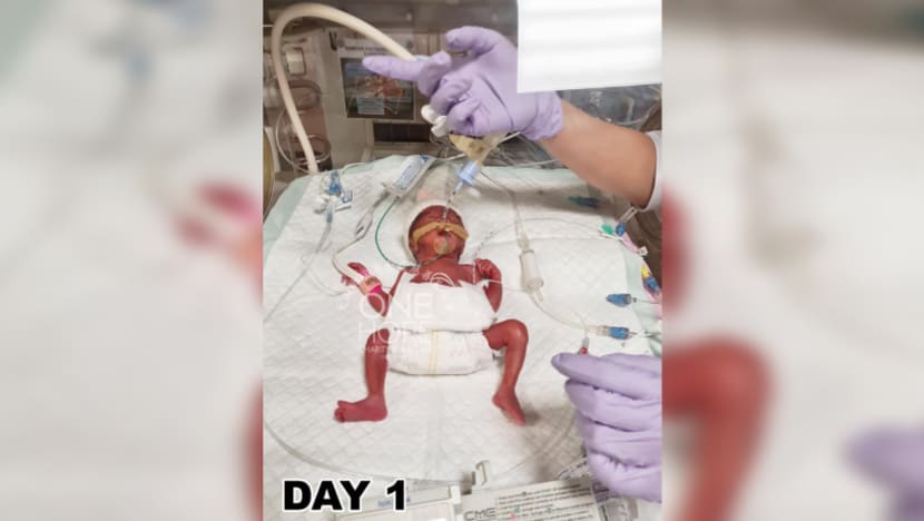 Related article image