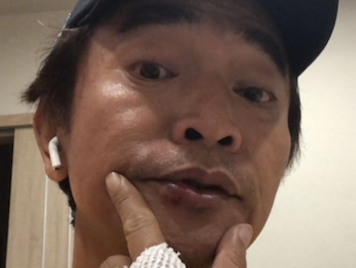 Jacky Wu Crashes Bike While Filming Variety Show; Says His Helmet