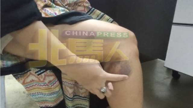 中国游客逛马国榴梿园被狗咬 索偿约800元被拒怒报警