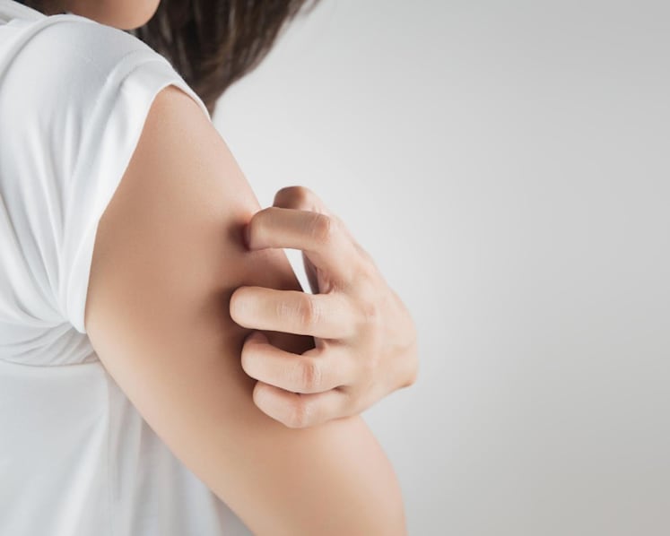 Why do you suddenly feel itchy? Why does scratching feel good? We answer your itch-related questions