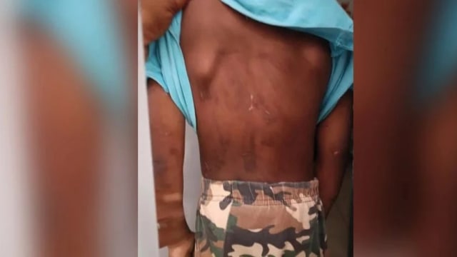 马国男童疑遭母亲和男友虐待 向邻居讨食物才揭发恶行