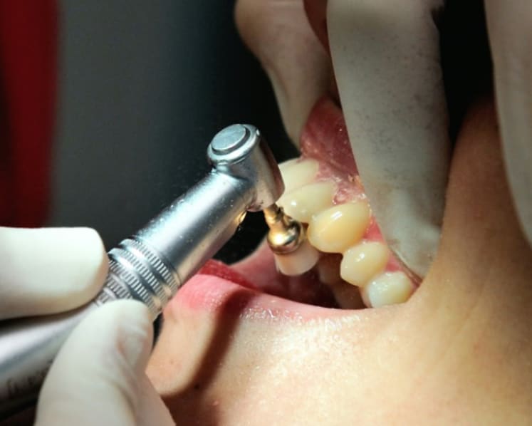 Commentary: Not brushing your teeth may increase your risk of severe COVID-19
