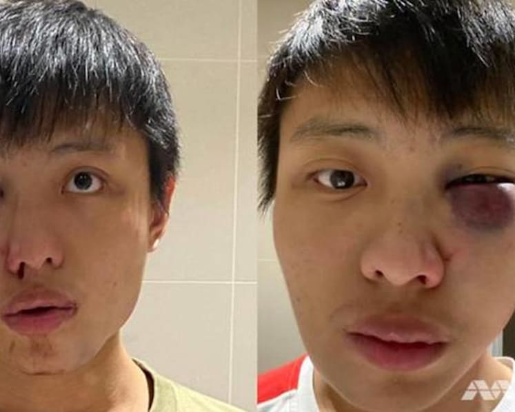 Teenager charged over Singaporean student attack in London sparked by Covid-19 comments