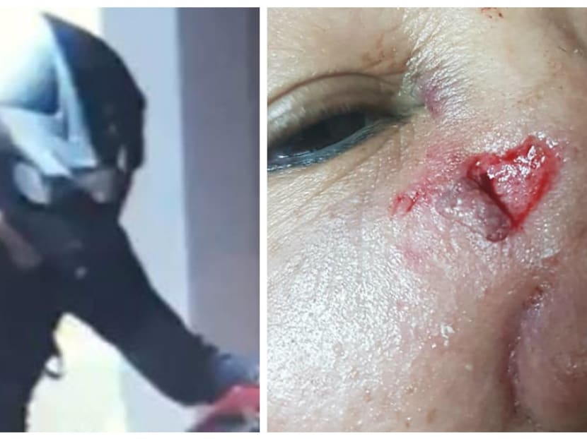 Mdm Lee, 65, suffered multiple injuries after a collision with an e-scooter on Tuesday (April 17).