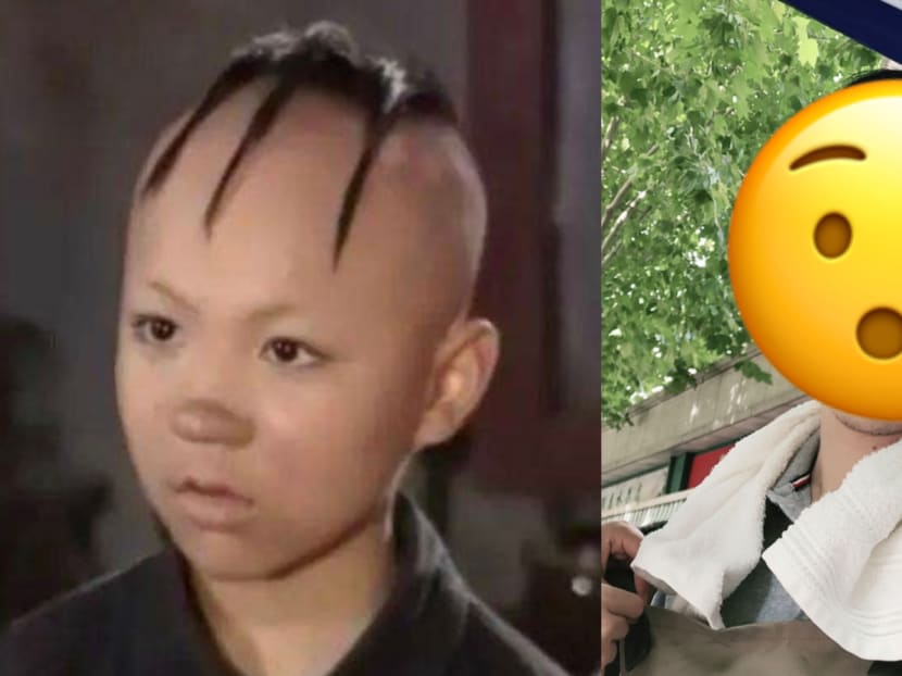 Chinese actor Meng Zhichao, who shot to fame as popular comic book hero Sanmao, had to endure getting 300 stitches, though.