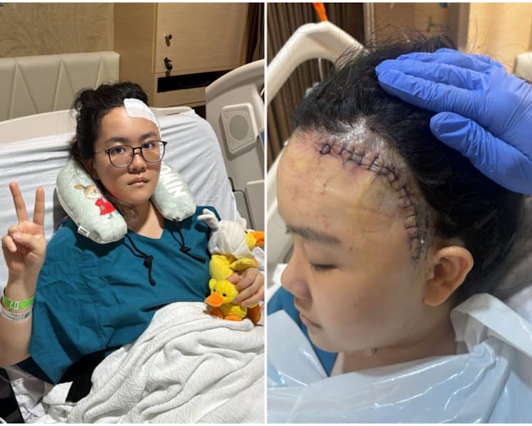 ‘So excruciatingly painful, I cried’: Without warning, blood vessel burst in 26-year-old Singaporean’s brain, leading to stroke