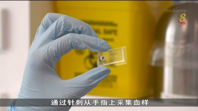 澳洲正研发芯片技术 向中风或心脏病患发风险警告